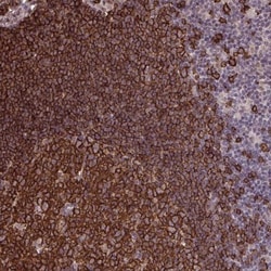 UXT Antibody, Novus Biologicals 0.1mL; Unlabeled:Antibodies, Polyclonal